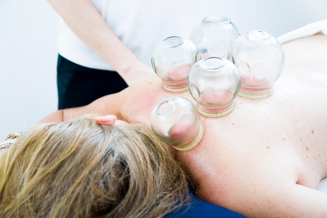 Services-01 cupping therapy, cupping massage, massage, alternative medicine, chinese traditional medicine, cupping therapy, cupping therapy, cupping therapy, cupping therapy, cupping therapy